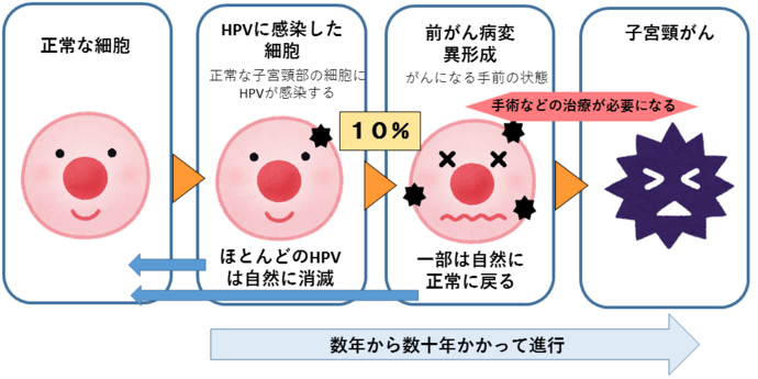 HPVウイルスによる子宮頸がんの進行